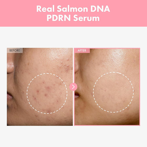 Pink Peptide 12 PDRN Serum With Salmon DNA, 12 Peptides, Corean skincare
